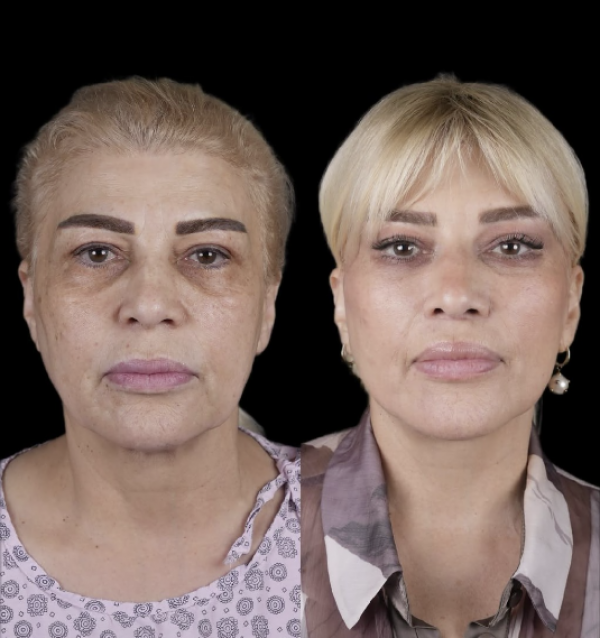 6917060bdc676202511253555