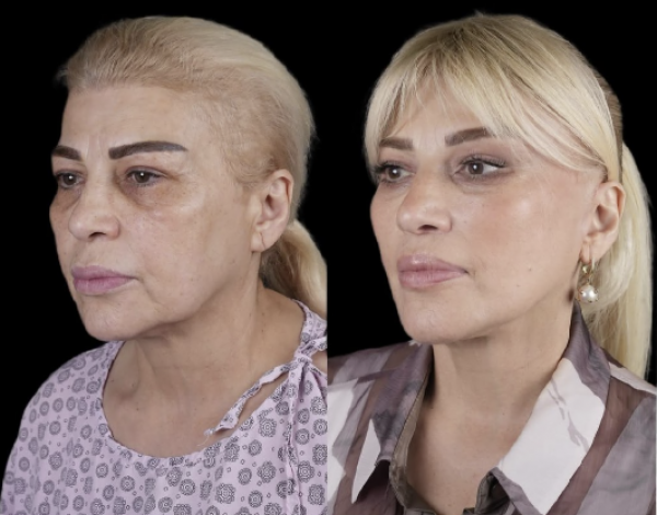 691706190d43e202511253609